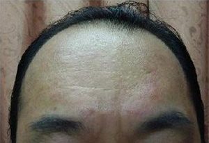 6ヶ月後