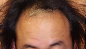6ヶ月後