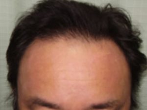 3ヶ月後