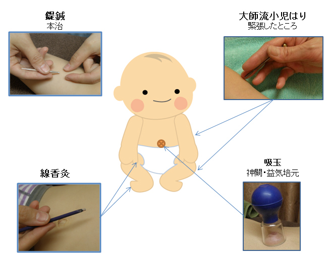 治療イメージ