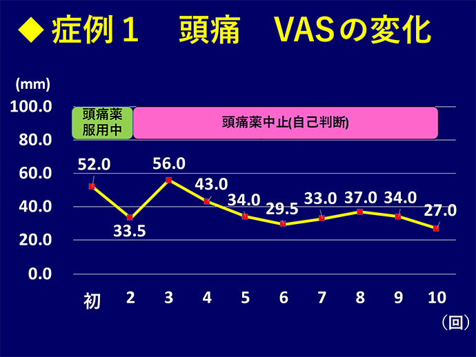 症例1 頭痛 VASの変化