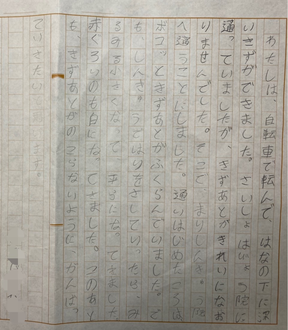 わたしは、自転車で転んで鼻の下に深い傷ができました。最初は病院に通っていましたが、傷跡がきれいに治りませんでした。 そこで、まり鍼灸院へ通う事にしました。 通い始めた頃は、ボコッと傷跡が膨らんでいました。 でも鍼灸で鍼を刺していったら、みるみる小さくなって、平らになってきました。 赤黒いのも白になってきました。 このあとも、傷跡が残らない様に頑張っていきたいと思います。 9歳/女性/大阪府岸和田　