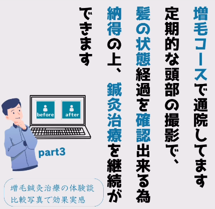 AGA（薄毛/脱毛/増毛）でお悩みの方