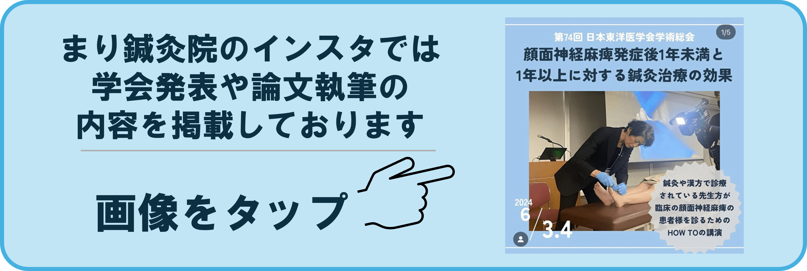 顔面神経麻痺顔面神経麻痺の講演など行っておりますInstagram