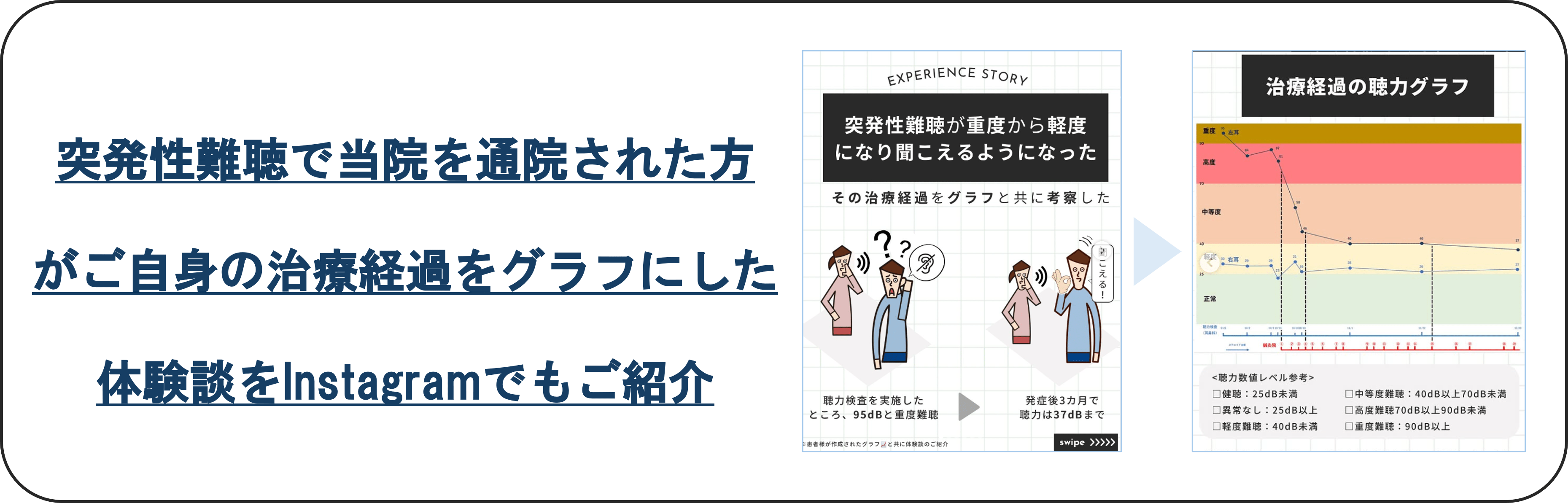 突発性難聴で当院を通院された方 がご自身の治療経過をグラフにした 体験談をInstagramでもご紹介